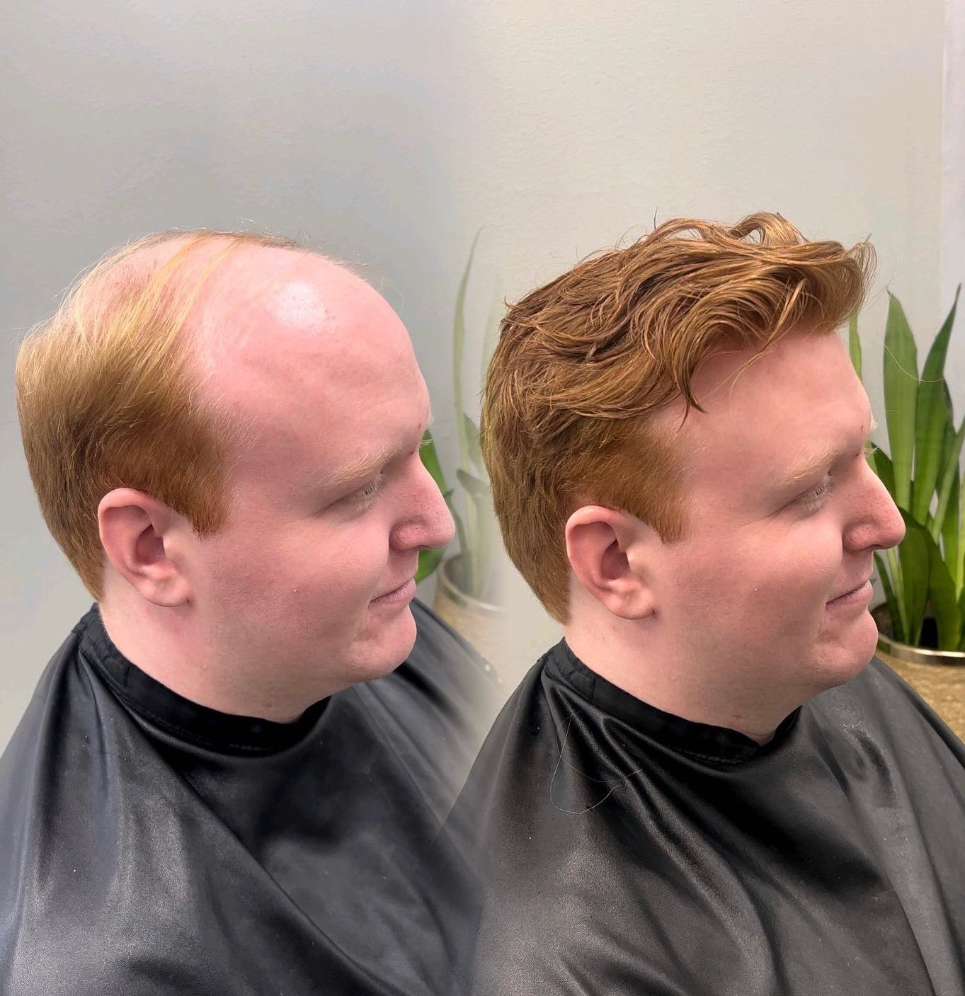 Natural-looking men's hair system result in Kansas City